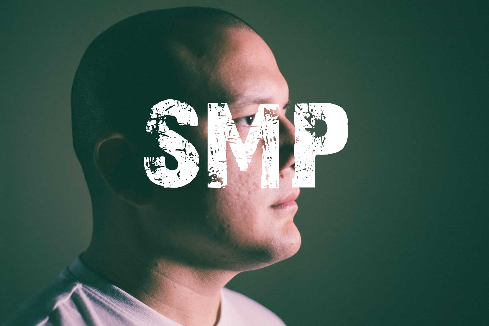 SMP for baldness